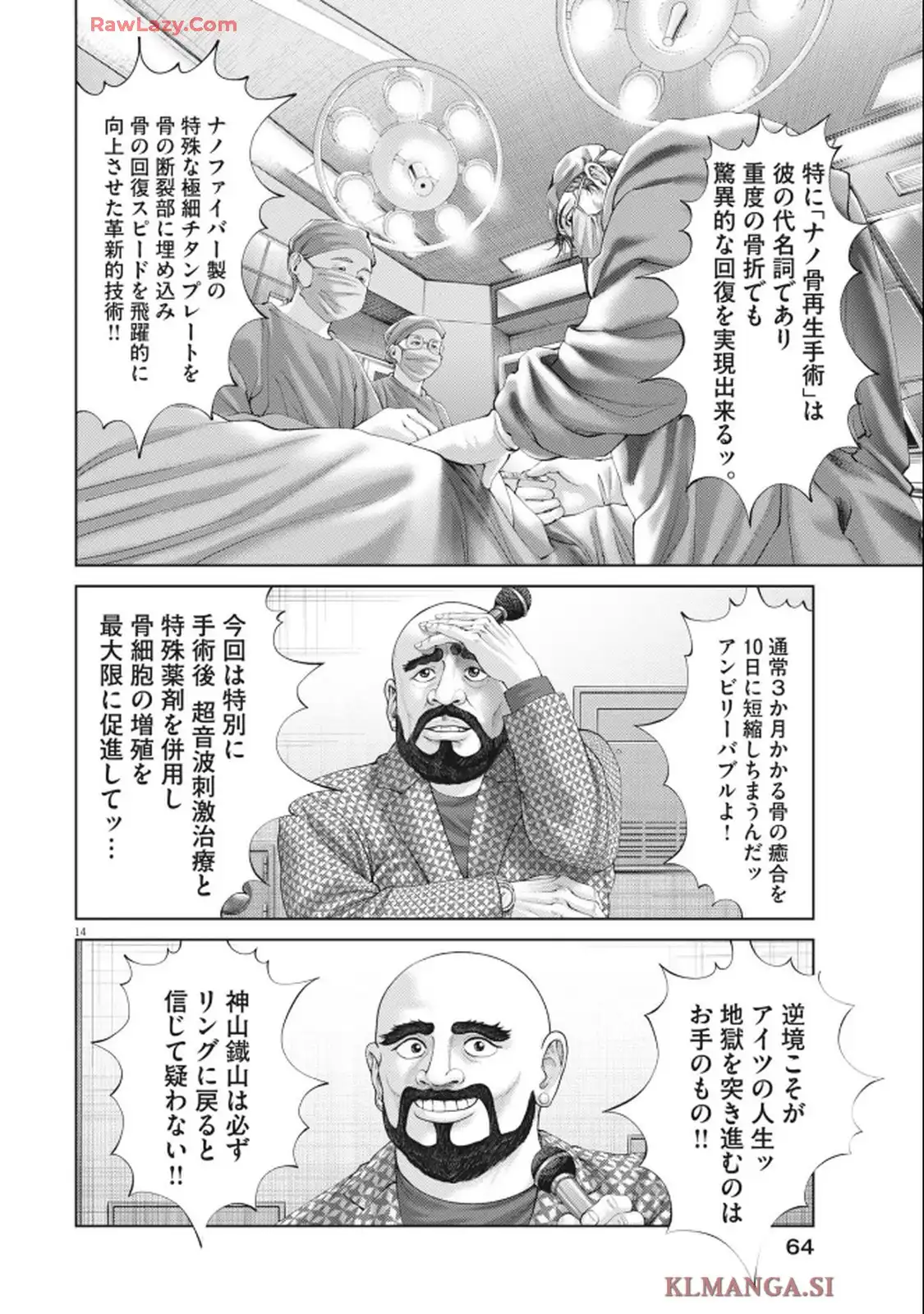 14