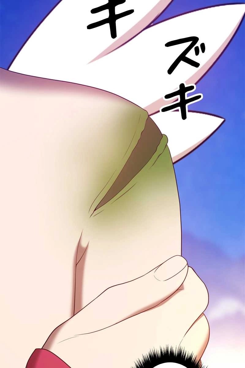 159